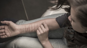 Why do people cut themselves? And how to help them stop